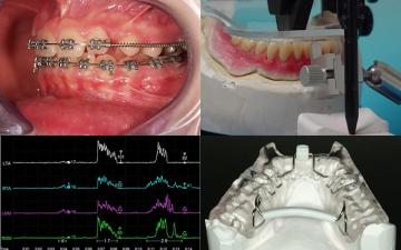 La Gnatologia  al Servizio dell'Ortodonzia, della Protesi Totale e delle OSAS