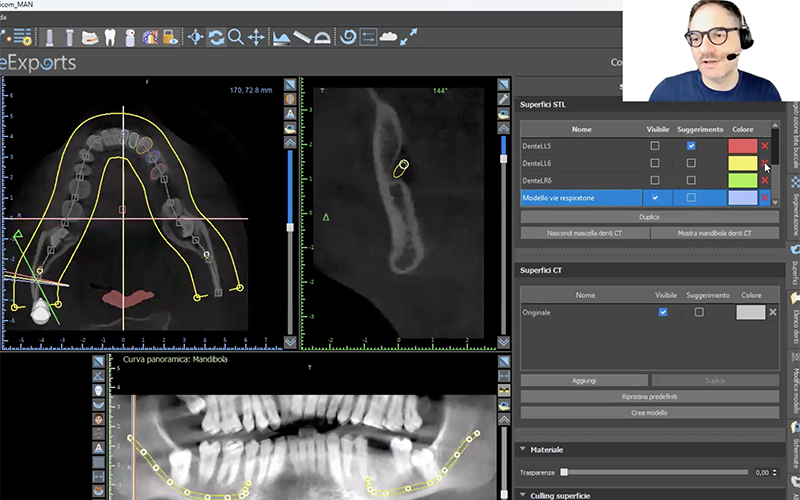 Corso Teorico Pratico sul software 3D Gratuito BlueSkyPlan in Chirurgia Guidata