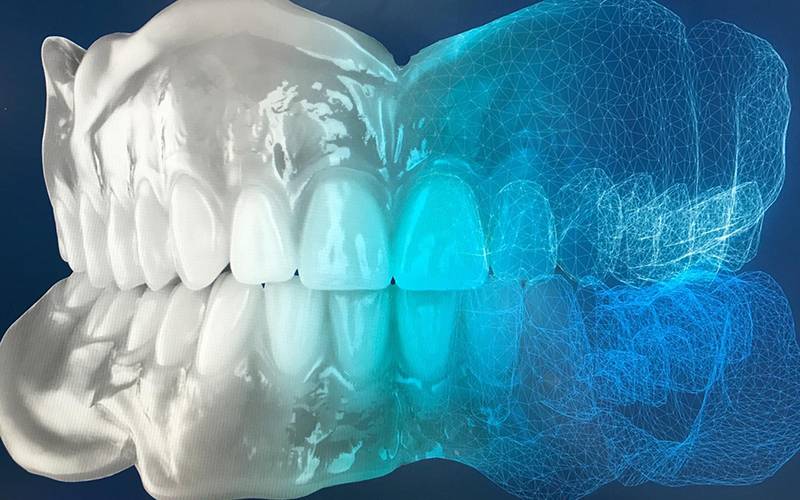 Corso Clinico Tecnico di Protesi Totale Digitale e Protesi Totale Semplificata